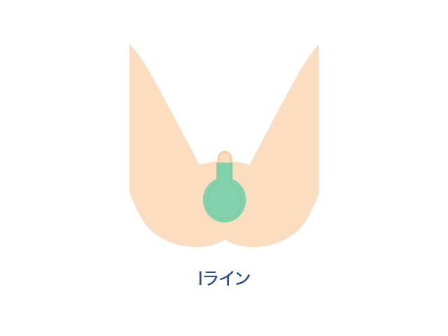 V・I・O(尻込)